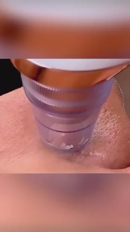 BLACKHEAD REMOVER